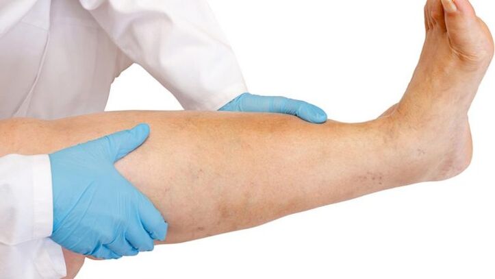 kā atpazīt slimību